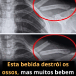 Refrigerante e Ossos: Entenda os Riscos para Sua Saúde Óssea b327f002-2f39-45a8-8796-1d2bb3421720-1