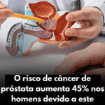 Câncer de Próstata: Risco Aumenta 45% por Falta de Exames