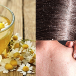 Chá de Camomila: Seus Benefícios para Saúde, Pele e Cabelo Chá de Camomila: Seus Benefícios para Saúde, Pele e Cabelo