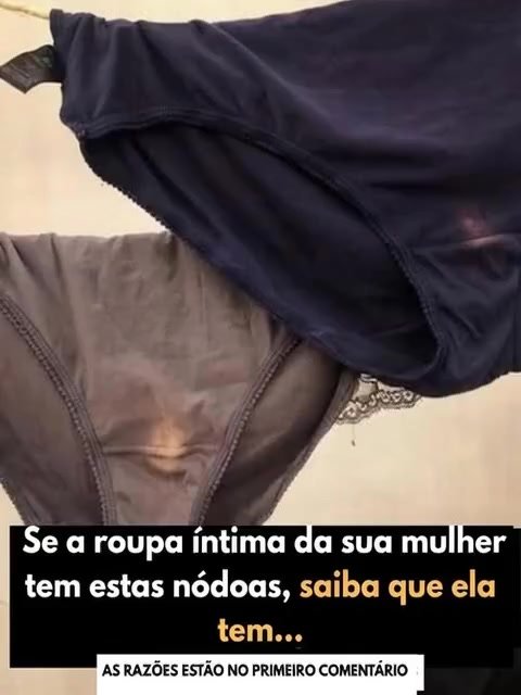 A Roupa Íntima da Sua Mulher Tem Essas Marcas? Desvende o Que Elas Realmente Significam!