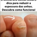 O Segredo da Vovó Adeus Unhas Grossas dos Pés preview-1787698298892
